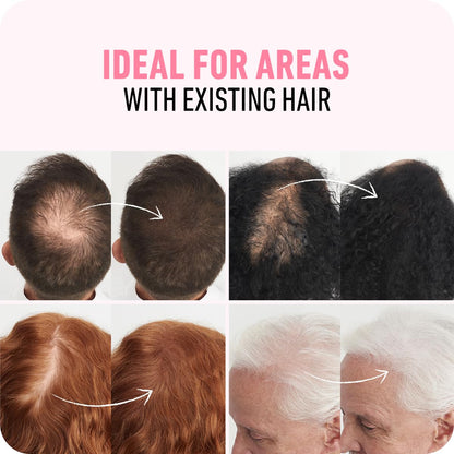Hair Fibers for Thinning Hair, for Women & Men, Medium Brown 28G