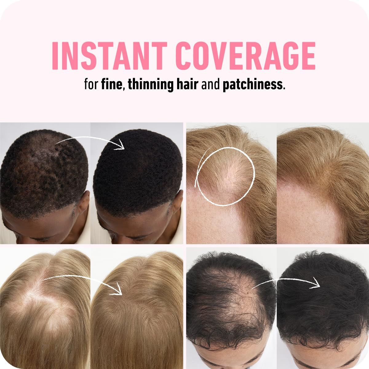 Hair Fibers for Thinning Hair, for Women & Men, Medium Brown 28G