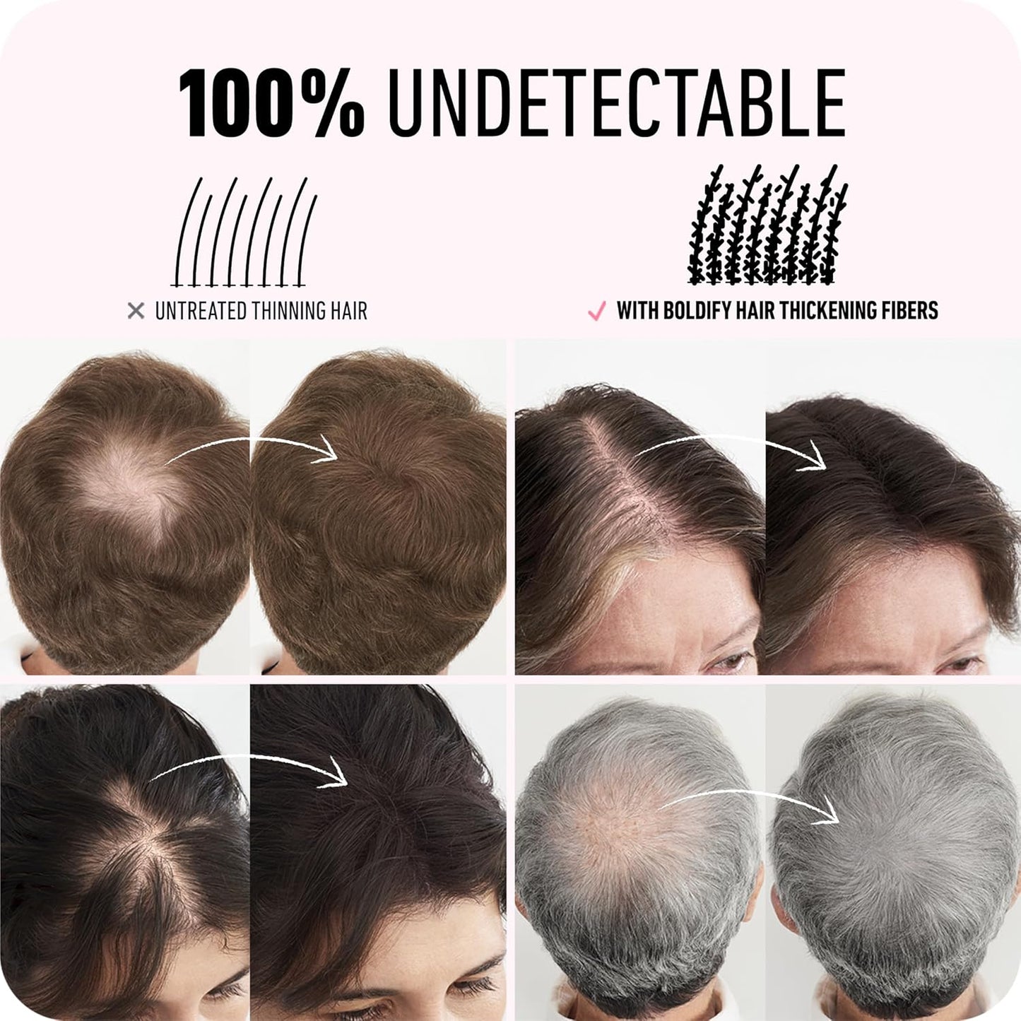 Hair Fibers for Thinning Hair, for Women & Men, Medium Brown 28G