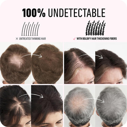 Hair Fibers for Thinning Hair, for Women & Men, Medium Brown 28G